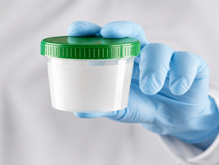 Preparaci&oacute;n en laboratorio
